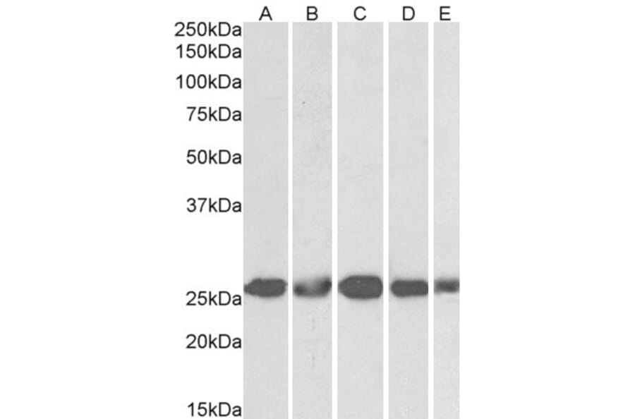Western Blot - Anti-Casein Kinase 2 beta Antibody (A82928) - Antibodies.com