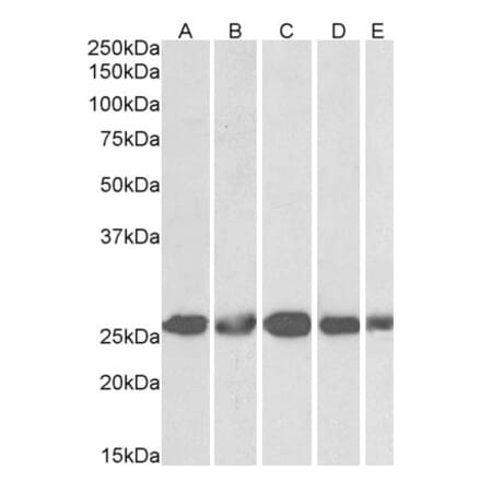 Western Blot - Anti-Casein Kinase 2 beta Antibody (A82928) - Antibodies.com