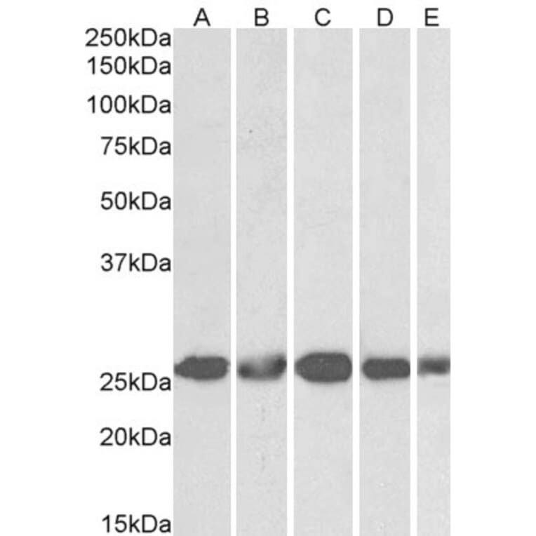 Western Blot - Anti-Casein Kinase 2 beta Antibody (A82928) - Antibodies.com