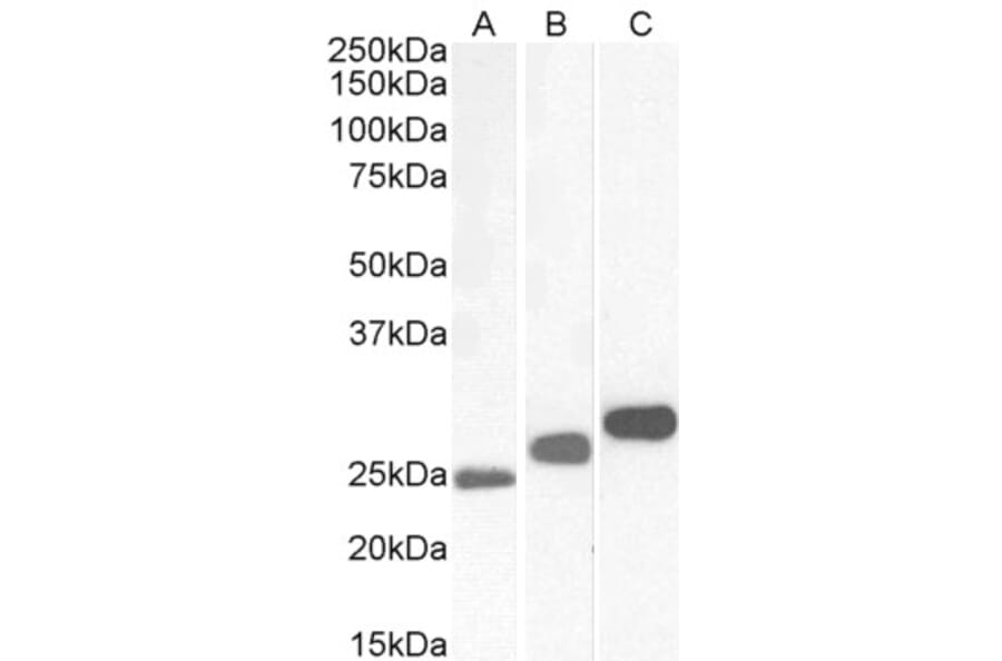 Western Blot - Anti-Casein Kinase 2 beta Antibody (A82928) - Antibodies.com