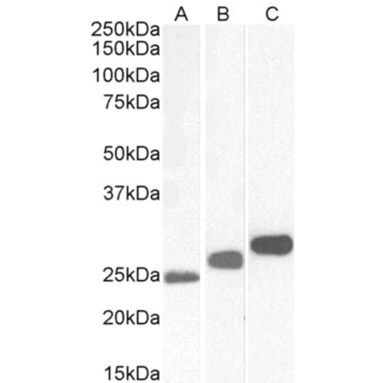 Western Blot - Anti-Casein Kinase 2 beta Antibody (A82928) - Antibodies.com
