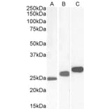 Western Blot - Anti-Casein Kinase 2 beta Antibody (A82928) - Antibodies.com
