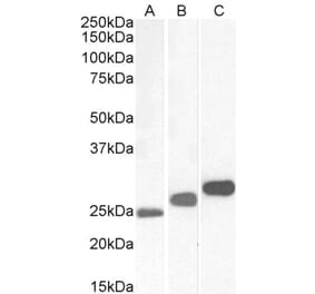 Western Blot - Anti-CSNK2B Antibody (A82928) - Antibodies.com