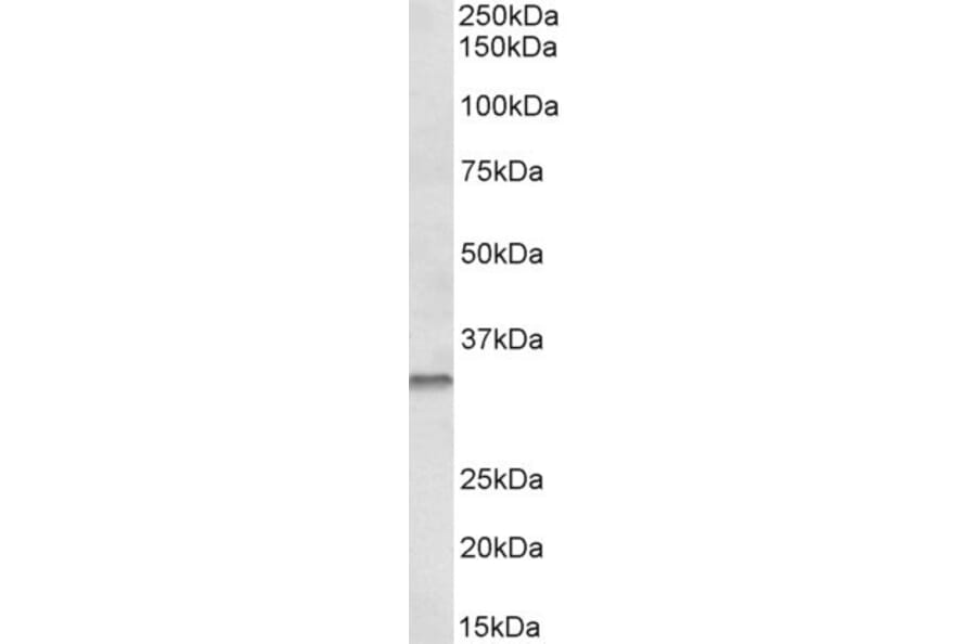 Western Blot - Anti-Caspase-6/CASP-6 Antibody (A82930) - Antibodies.com