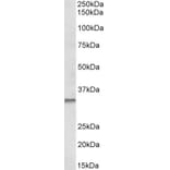 Western Blot - Anti-Caspase-6/CASP-6 Antibody (A82930) - Antibodies.com
