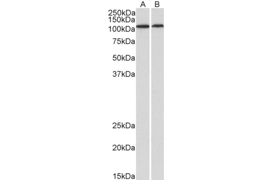 Western Blot - Anti-BMP1/PCP Antibody (A82931) - Antibodies.com