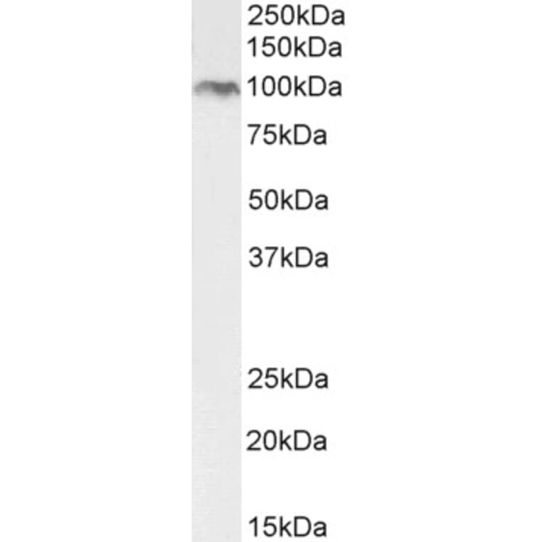 Western Blot - Anti-BMP1/PCP Antibody (A82931) - Antibodies.com