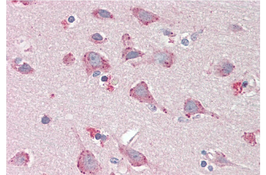 Immunohistochemistry - Anti-BMP1/PCP Antibody (A82931) - Antibodies.com