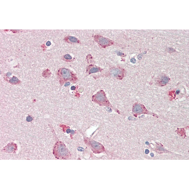 Immunohistochemistry - Anti-BMP1/PCP Antibody (A82931) - Antibodies.com