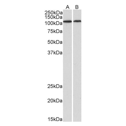 Western Blot - Anti-BMP1 Antibody (A82931) - Antibodies.com