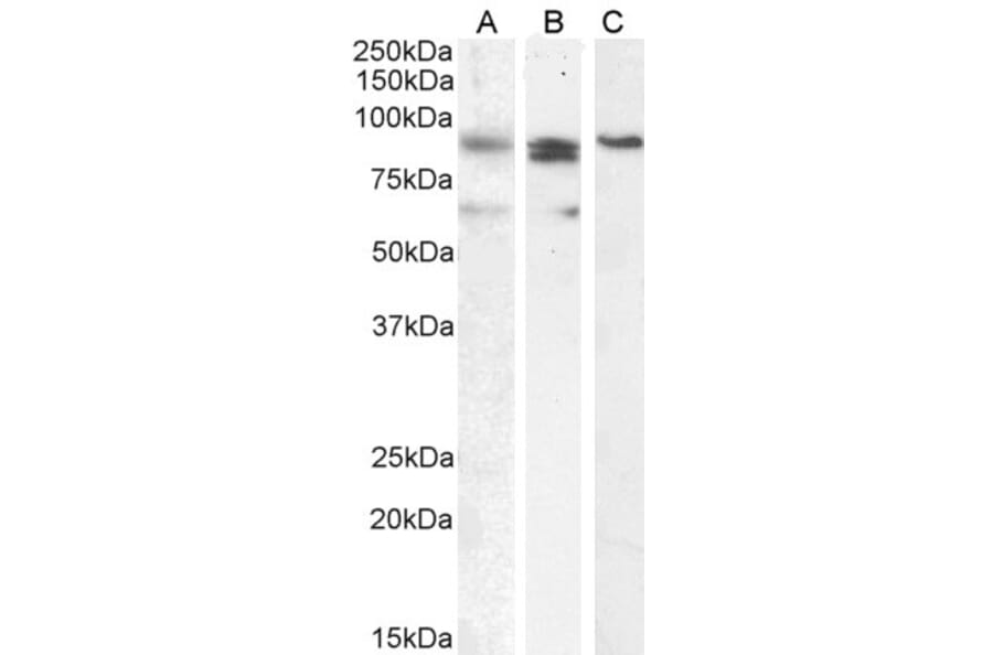 Western Blot - Anti-PRDM1/Blimp1 Antibody (A82932) - Antibodies.com