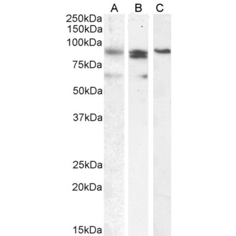 Western Blot - Anti-PRDM1/Blimp1 Antibody (A82932) - Antibodies.com