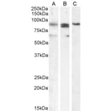 Western Blot - Anti-PRDM1/Blimp1 Antibody (A82932) - Antibodies.com