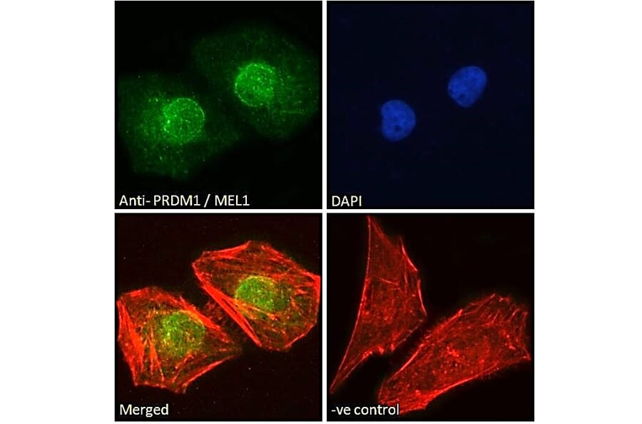 Immunofluorescence - Anti-PRDM1/Blimp1 Antibody (A82932) - Antibodies.com
