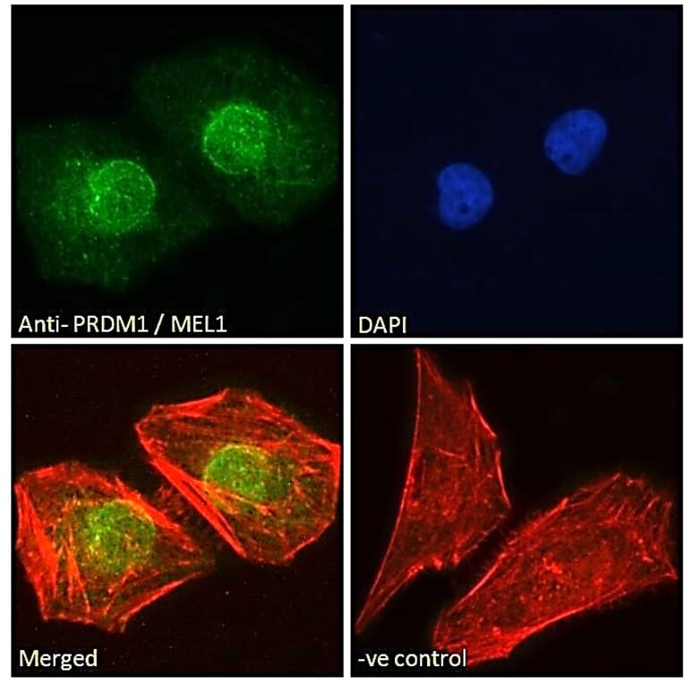 Immunofluorescence - Anti-PRDM1/Blimp1 Antibody (A82932) - Antibodies.com