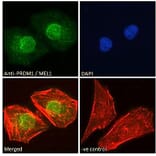 Immunofluorescence - Anti-PRDM1/Blimp1 Antibody (A82932) - Antibodies.com