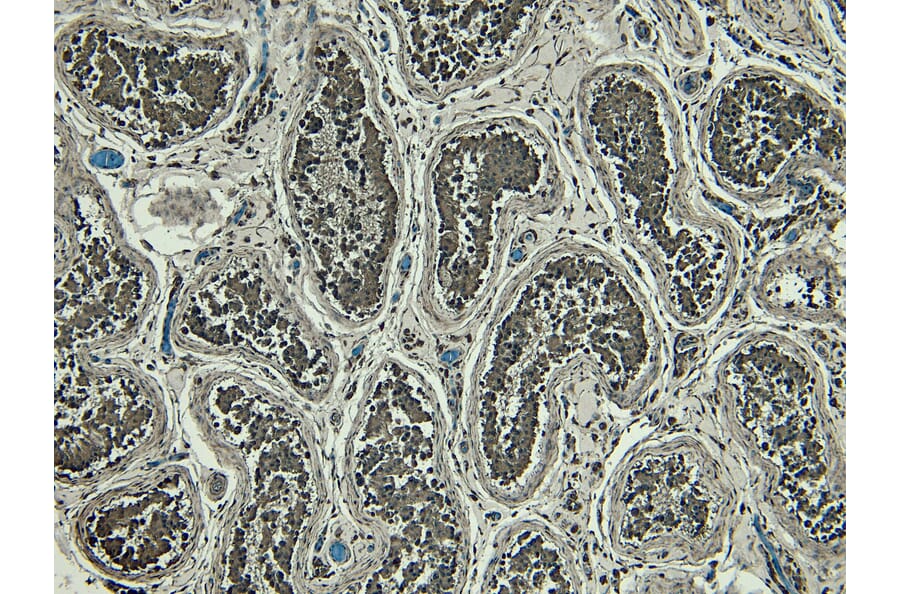 Immunohistochemistry - Anti-PRDM1/Blimp1 Antibody (A82932) - Antibodies.com