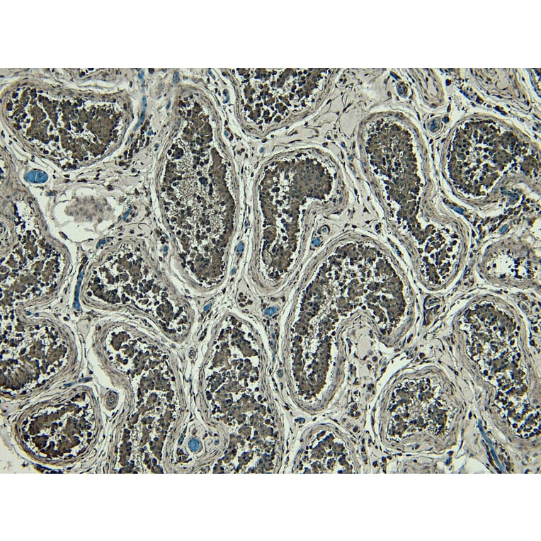 Immunohistochemistry - Anti-PRDM1/Blimp1 Antibody (A82932) - Antibodies.com