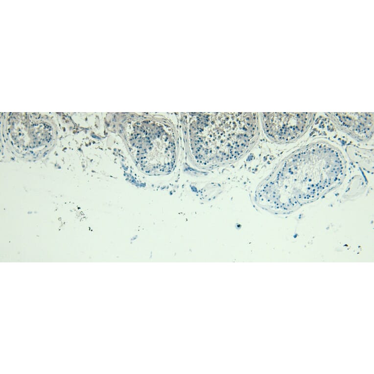 Immunohistochemistry - Anti-PRDM1/Blimp1 Antibody (A82932) - Antibodies.com
