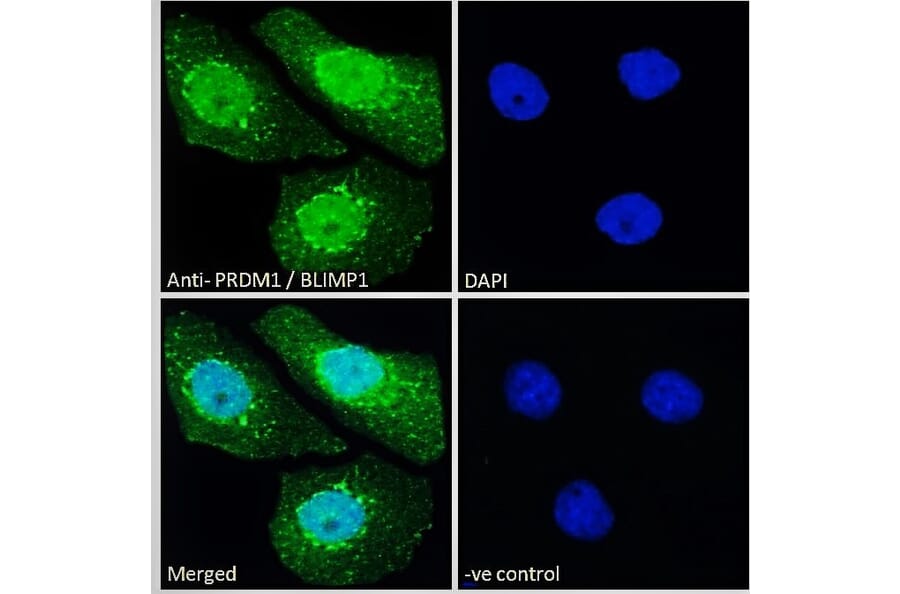 Immunofluorescence - Anti-PRDM1/Blimp1 Antibody (A82933) - Antibodies.com