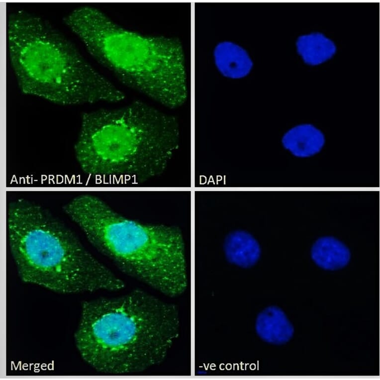 Immunofluorescence - Anti-PRDM1/Blimp1 Antibody (A82933) - Antibodies.com