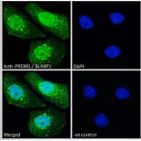 Immunofluorescence - Anti-PRDM1/Blimp1 Antibody (A82933) - Antibodies.com
