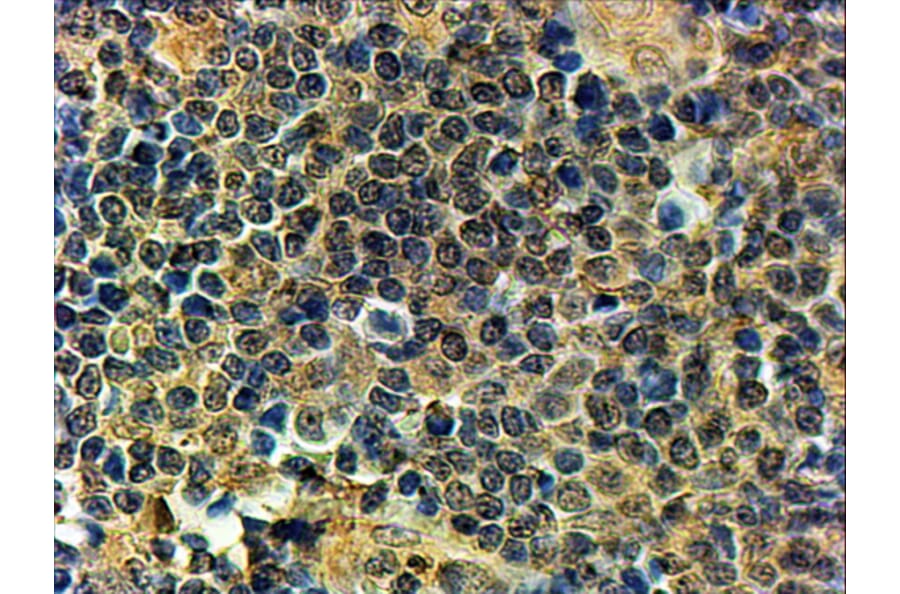 Immunohistochemistry - Anti-PRDM1/Blimp1 Antibody (A82933) - Antibodies.com