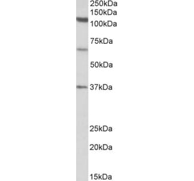 Western Blot - Anti-CP110 Antibody (A82934) - Antibodies.com