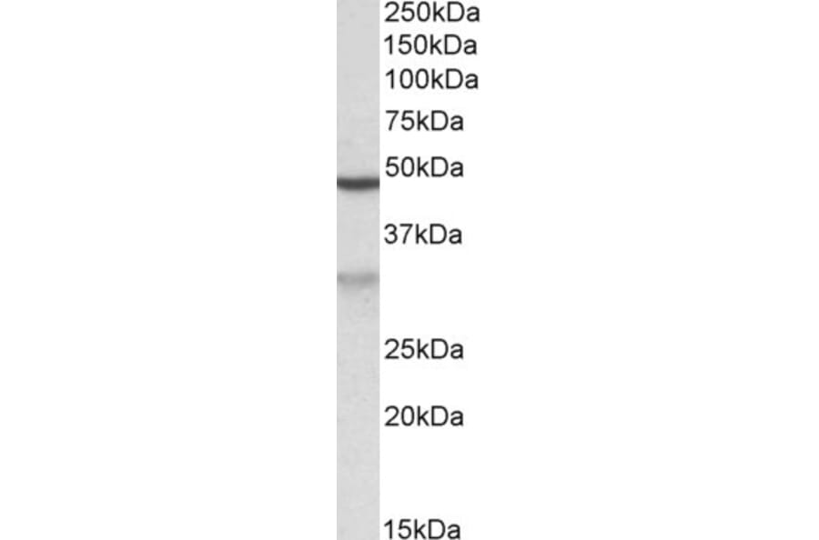 Western Blot - Anti-HCCA2 Antibody (A82936) - Antibodies.com