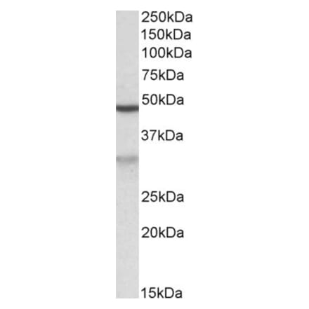 Western Blot - Anti-HCCA2 Antibody (A82936) - Antibodies.com