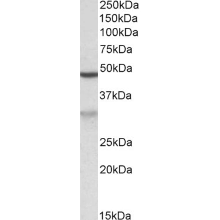 Western Blot - Anti-HCCA2 Antibody (A82936) - Antibodies.com