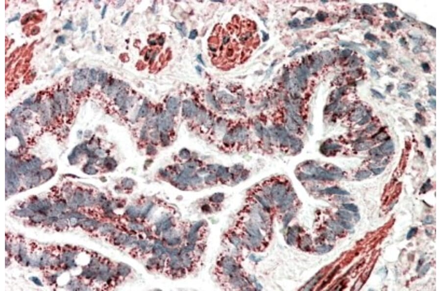 Immunohistochemistry - Anti-HCCA2 Antibody (A82936) - Antibodies.com