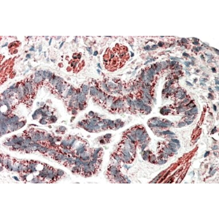 Immunohistochemistry - Anti-HCCA2 Antibody (A82936) - Antibodies.com