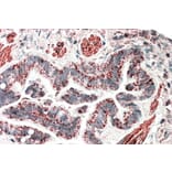 Immunohistochemistry - Anti-HCCA2 Antibody (A82936) - Antibodies.com