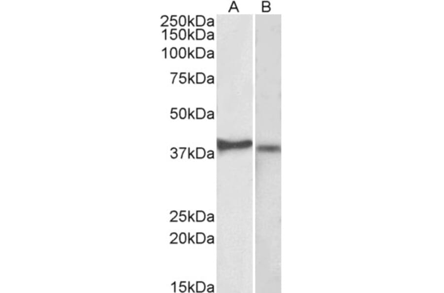 Western Blot - Anti-CX3CR1 Antibody (A82937) - Antibodies.com