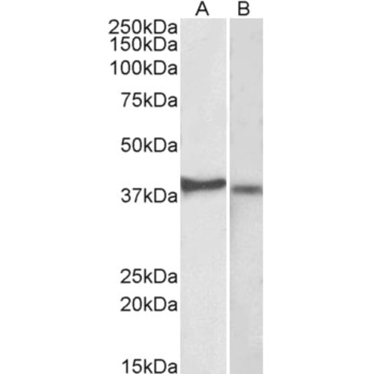 Western Blot - Anti-CX3CR1 Antibody (A82937) - Antibodies.com