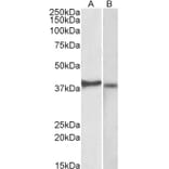 Western Blot - Anti-CX3CR1 Antibody (A82937) - Antibodies.com