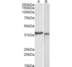 Western Blot - Anti-CX3CR1 Antibody (A82937) - Antibodies.com