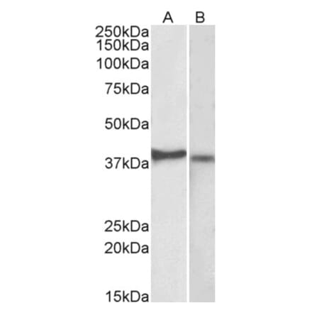Western Blot - Anti-CX3CR1 Antibody (A82937) - Antibodies.com