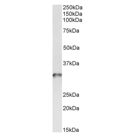 Western Blot - Anti-TPM4 Antibody (A82938) - Antibodies.com