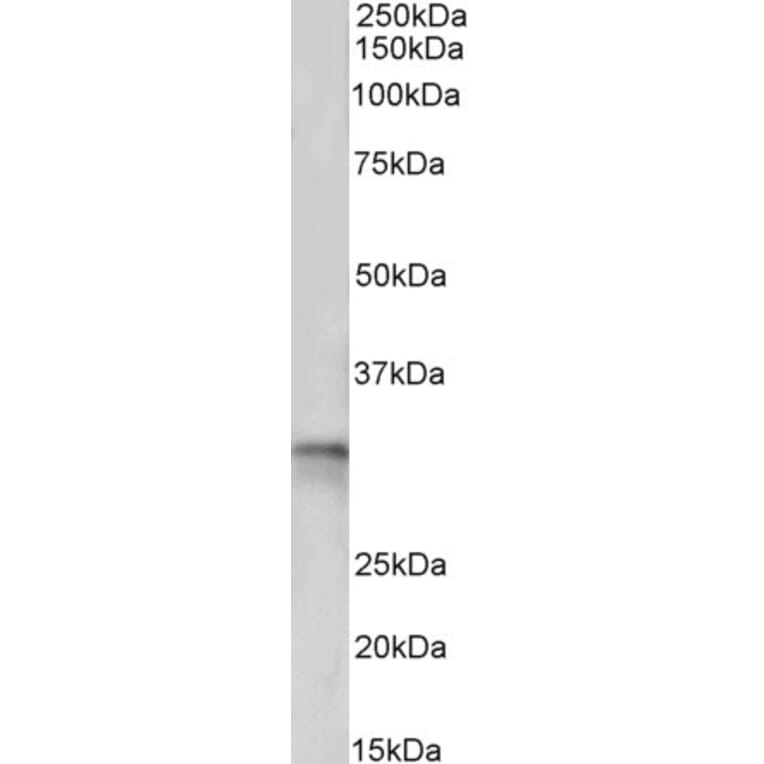 Western Blot - Anti-TPM4 Antibody (A82938) - Antibodies.com