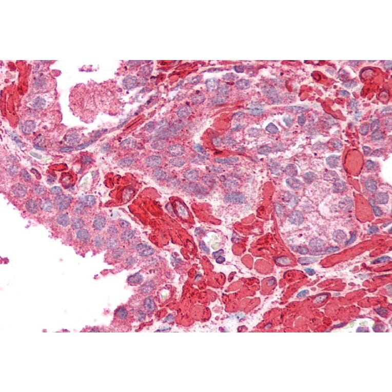 Immunohistochemistry - Anti-TPM4 Antibody (A82938) - Antibodies.com