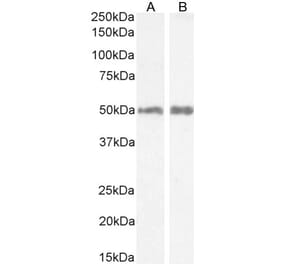 Western Blot - Anti-H2R Antibody (A82941) - Antibodies.com