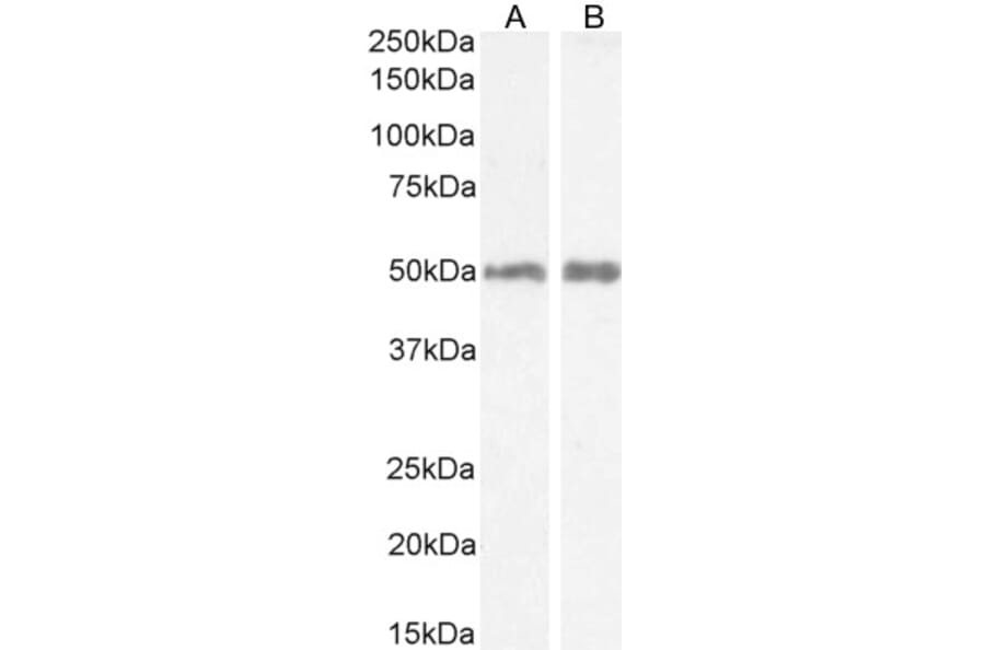 Western Blot - Anti-H2R Antibody (A82941) - Antibodies.com
