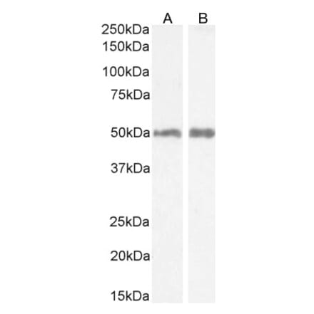 Western Blot - Anti-H2R Antibody (A82941) - Antibodies.com
