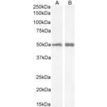 Western Blot - Anti-H2R Antibody (A82941) - Antibodies.com