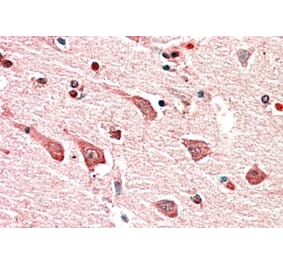 Immunohistochemistry - Anti-MYO1B Antibody (A82942) - Antibodies.com