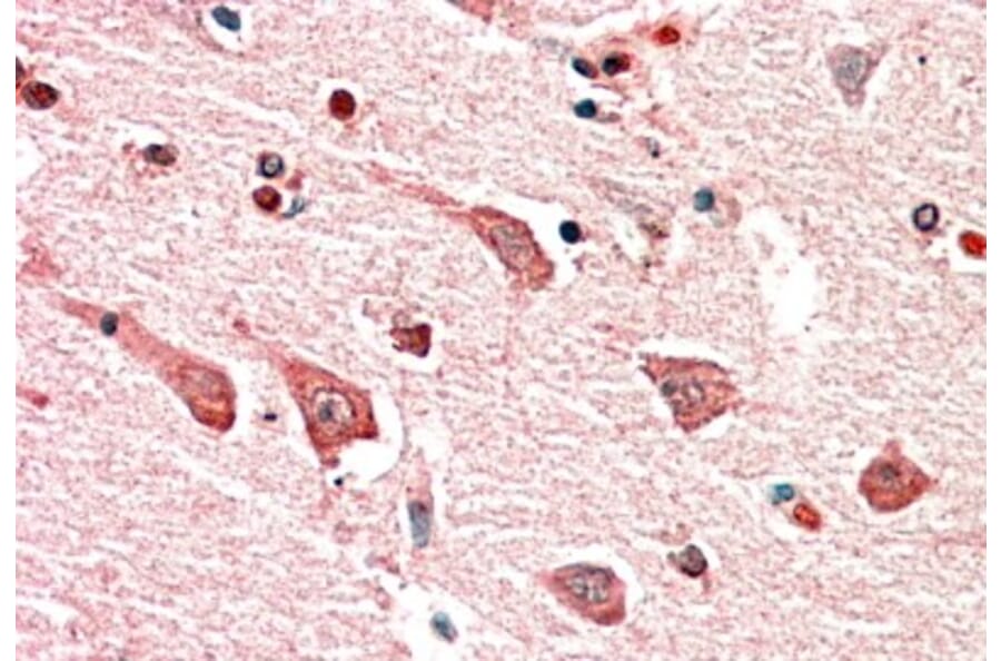 Immunohistochemistry - Anti-MYO1B Antibody (A82942) - Antibodies.com
