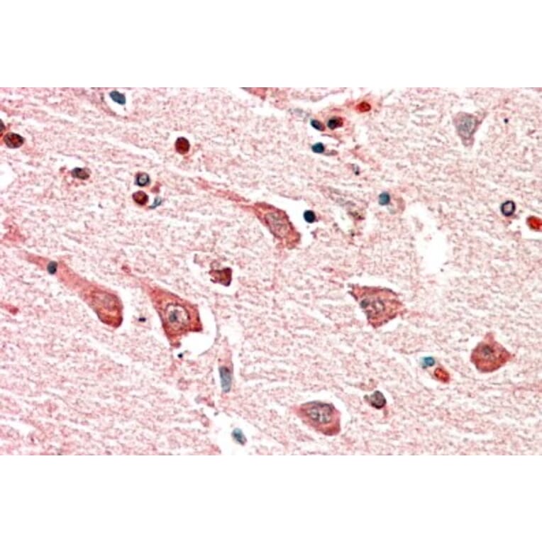 Immunohistochemistry - Anti-MYO1B Antibody (A82942) - Antibodies.com