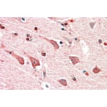 Immunohistochemistry - Anti-MYO1B Antibody (A82942) - Antibodies.com